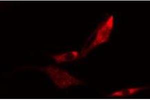 ABIN6275120 staining  HeLa cells by IF/ICC. (EIF3K 抗体  (N-Term))