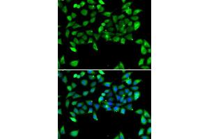 Immunofluorescence analysis of U2OS cells using EIF3H antibody. (EIF3H 抗体  (AA 80-340))
