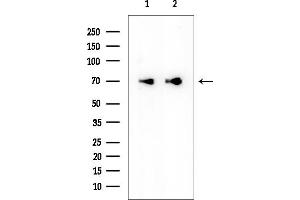 Western blot analysis of lysates from various samples, using SLC39A12 Mouse Monoclonal Antibody at 1/1000 dilution.