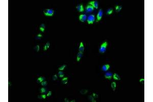 Immunofluorescence staining of Hela cells with ABIN7149348 at 1:133, counter-stained with DAPI. (CPEB4 抗体  (AA 244-515))