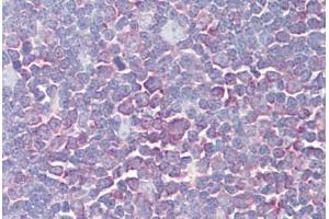 Image no. 2 for anti-PTK2B Protein tyrosine Kinase 2 beta (PTK2B) (AA 812-861) antibody (ABIN1500493) (PTK2B 抗体  (AA 812-861))