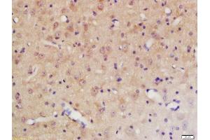 Formalin-fixed and paraffin embedded rat brain labeled with Rabbit Anti-PTPN11 (Tyr584) Polyclonal Antibody, Unconjugated 1:200 followed by conjugation to the secondary antibody and DAB staining (PTPN11 抗体  (pTyr584))