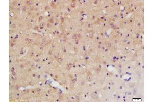 Immunohistochemistry (Paraffin-embedded Sections) (IHC (p)) image for anti-Protein tyrosine Phosphatase, Non-Receptor Type 11 (PTPN11) (pTyr584) antibody (ABIN745838)