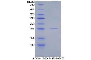 SDS-PAGE analysis of Rat SFRP1 Protein. (SFRP1 蛋白)