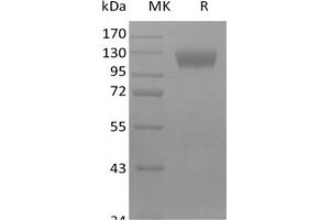Western Blotting (WB) image for Sialic Acid Binding Ig-Like Lectin 10 (SIGLEC10) protein (Fc Tag) (ABIN7320907)