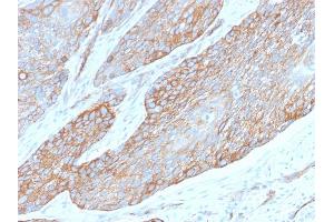 Formalin-fixed, paraffin-embedded human Pancreas stained with Spectrin Beta 3 Rabbit Monoclonal Antibody (SPTBN2/2979R). (Recombinant Spectrin, Beta, Non-erythrocytic 2 (SPTBN2) (AA 356-475) 抗体)