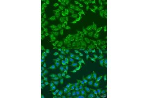 Immunofluorescence analysis of U2OS cells using  antibody  at dilution of 1:100. (ADAP1 抗体  (AA 1-374))