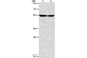 Western blot analysis of Mouse heart tissue and hela cell, using ILK Polyclonal Antibody at dilution of 1:600 (ILK 抗体)