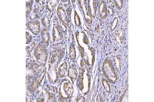 IHC analysis of TOM1L1 using anti-TOM1L1 antibody (ABIN7602631). (TOM1L1 抗体  (AA 9-448))