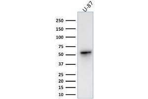 Western Blot Analysis of human U-87 cell lysate using Vimentin Rabbit Recombinant Monoclonal Antibody (VIM/1937R). (Recombinant Vimentin 抗体)