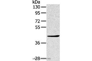 Western blot analysis of A431 cell, using TNIP2 Polyclonal Antibody at dilution of 1:500 (TNIP2 抗体)