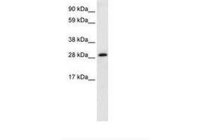 Image no. 2 for anti-Activator of Basal Transcription 1 (Abt1) (AA 174-223) antibody (ABIN202142) (Activator of Basal Transcription 1 抗体  (AA 174-223))