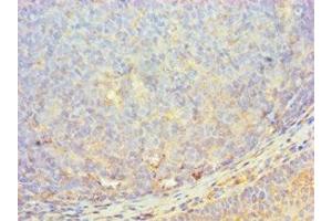 Immunohistochemistry of paraffin-embedded human tonsil tissue using ABIN7174047 at dilution of 1:100 (MERTK 抗体  (AA 840-999))