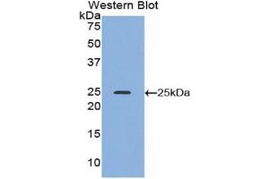 Western blot analysis of the recombinant protein. (ADH1 抗体  (AA 25-228))