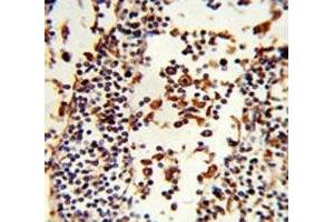 IHC analysis of FFPE human lymph tissue stained with IGHA1 antibody (IGHA1 抗体  (AA 257-286))