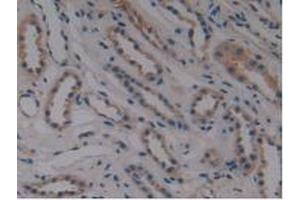 Detection of MPP6 in Human Kidney Tissue using Polyclonal Antibody to Membrane Protein, Palmitoylated 6 (MPP6) (MPP6 抗体  (AA 331-503))