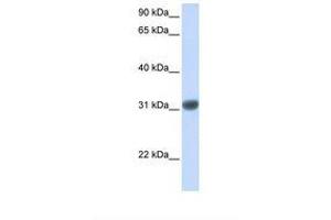 Image no. 1 for anti-Orthodenticle Homeobox 2 (OTX2) (AA 110-159) antibody (ABIN6737647) (OTX2 抗体  (AA 110-159))