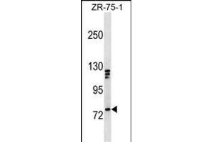 KIF3A Antibody (C-term) (ABIN1537505 and ABIN2850289) western blot analysis in ZR-75-1 cell line lysates (35 μg/lane). (KIF3A 抗体  (C-Term))