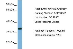 WB Suggested Anti-YWHAE Antibody   Titration: 1. (YWHAE 抗体  (C-Term))