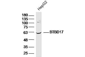 Lane 1: HepG2 lysates probed with BTBD17 Polyclonal Antibody, Unconjugated  at 1:300 overnight at 4˚C. (BTBD17 抗体  (AA 101-200))
