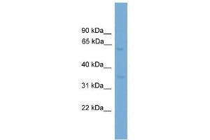 Western Blot showing MFSD8 antibody used at a concentration of 1-2 ug/ml to detect its target protein.