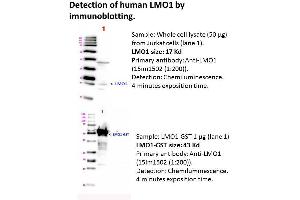Image no. 1 for anti-LIM Domain Only 1 (Rhombotin 1) (LMO1) antibody (ABIN1112421) (LMO1 抗体)