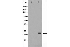 Western blot analysis on K562 cell lysate using NM23 Antibody. (NME2 抗体  (Internal Region))