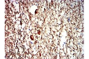 Immunohistochemical analysis of paraffin-embedded human medulla oblongata tissues using NEFH mouse mAb with DAB staining. (NEFH 抗体  (AA 2-251))