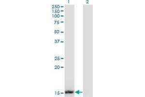 Western Blot analysis of UBE2B expression in transfected 293T cell line by UBE2B monoclonal antibody (M13), clone 1F11. (UBE2B 抗体  (AA 1-152))