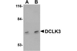 Western blot analysis of DCLK3 in K562 cell lysate with AP30278PU-N DCLK3 antibody at (A) 1 and (B) 2 μg/ml. (DCLK3 抗体  (N-Term))