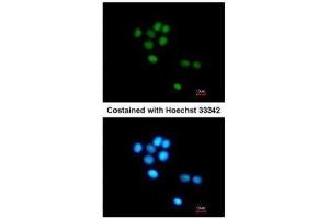 ICC/IF Image Immunofluorescence analysis of methanol-fixed HepG2, using TULP3, antibody at 1:200 dilution. (TULP3 抗体)