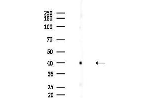 Western blot analysis of lysates from EC304 cells, using GIRK1/KIR3.