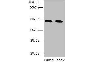 Western blot All lanes: IGSF11 antibody at 1. (IGSF11 抗体  (AA 23-241))