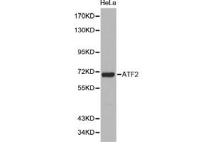 Western Blotting (WB) image for anti-Activating Transcription Factor 2 (ATF2) (AA 1-190) antibody (ABIN6219371) (ATF2 抗体  (AA 1-190))