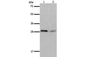 Western Blot analysis of Mouse brain and kidney tissue using KLK7 Polyclonal Antibody at dilution of 1:600 (Kallikrein 7 抗体)
