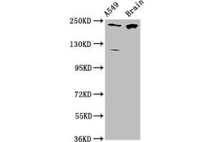Western Blot Positive WB detected in: A549 whole cell lysate, Rat brain tissue All lanes: CABIN1 antibody at 3. (CABIN1 抗体  (AA 1978-2123))