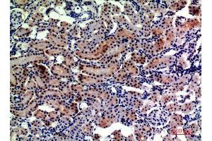 Immunohistochemistry (IHC) analysis of paraffin-embedded Rat Kidney, antibody was diluted at 1:200.