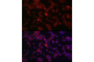 Immunofluorescence analysis of Jurkat cells using CD45 Rabbit pAb (ABIN3022953, ABIN3022954, ABIN3022955, ABIN1513451 and ABIN6219315) at dilution of 1:100 (40x lens). (CD45 抗体  (AA 890-990))