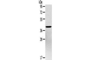 Western Blotting (WB) image for anti-Pentraxin 3 (PTX3) antibody (ABIN2434027) (PTX3 抗体)