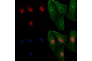 ABIN6265491 and ABIN6266698 staining  cells by IF/ICC. (TBX2/3 (Internal Region) 抗体)