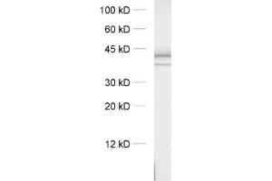 dilution: 1 : 1000, sample: crude synaptosomal fraction of rat brain (P2) (Syntaxin 16 抗体  (AA 1-302))