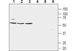 Western blot analysis of Burkitt's lymphoma (Raji) (lanes 1 and 4), human prostate carcinoma (LNCaP) (lanes 2 and 5) and human prostate carcinoma (PC-3) cell line lysates (lanes 3 and 6): - 1-3. (CXCR5 抗体  (Extracellular, N-Term))