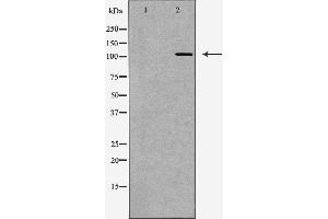 Western blot analysis of Hela whole cell lysates, using PARP1 Antibody.
