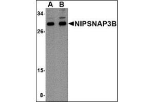 Western blot analysis of NIPSNAP3B in mouse brain tissue lysate with this product at (A) 1 and (B) 2 μg/ml. (NIPSNAP3B 抗体  (Center))