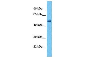 Host:  Rabbit  Target Name:  PHF15  Sample Type:  Liver Tumor lysates  Antibody Dilution:  1. (PHF15 抗体  (C-Term))