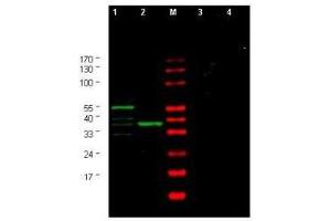 Western blot using  Affinity Purified anti-Yeast CHK1 antibody shows detection of a bands corresponding to CHK1 in Saccharomyces cerevisiae lysates. (CHEK1 抗体  (AA 312-327))