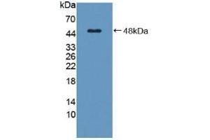 Detection of Recombinant C8g, Human using Polyclonal Antibody to Complement Component 8g (C8g) (C8G 抗体  (AA 39-202))