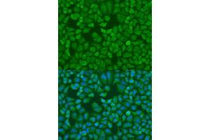 Immunofluorescence analysis of U2OS cells using IGF2BP1 antibody. (IGF2BP1 抗体  (C-Term))
