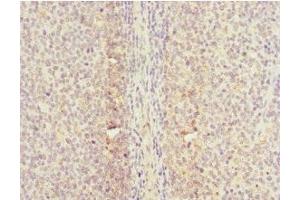 Immunohistochemistry of paraffin-embedded human tonsil tissue using ABIN7147293 at dilution of 1:100 (CDC7 抗体  (AA 275-574))
