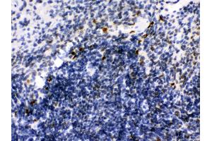 Anti- Ikaros Picoband antibody, IHC(P) IHC(P): Mouse Spleen Tissue (IKZF1 抗体  (C-Term))